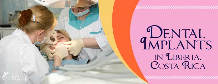 Dental Implants in Liberia, Costa Rica Dental Implants in Liberia, Costa Rica