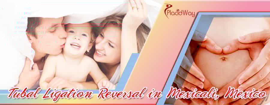 Tubal Ligation Reversal in Mexicali, Mexico