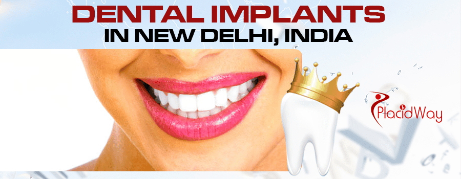 Dental implants in New delhi, India Dental implants in New delhi, India