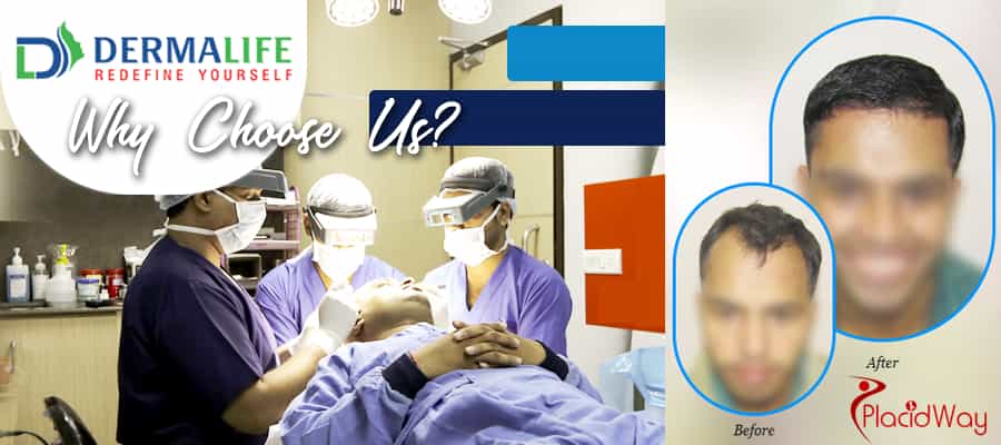 Hait Transplant Surgery in India Hait Transplant Surgery in India