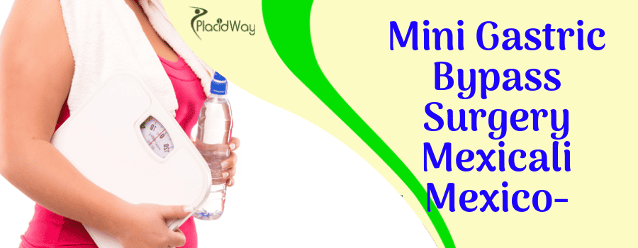 Best Mini Gastric Bypass Package in Mexicali, Mexico