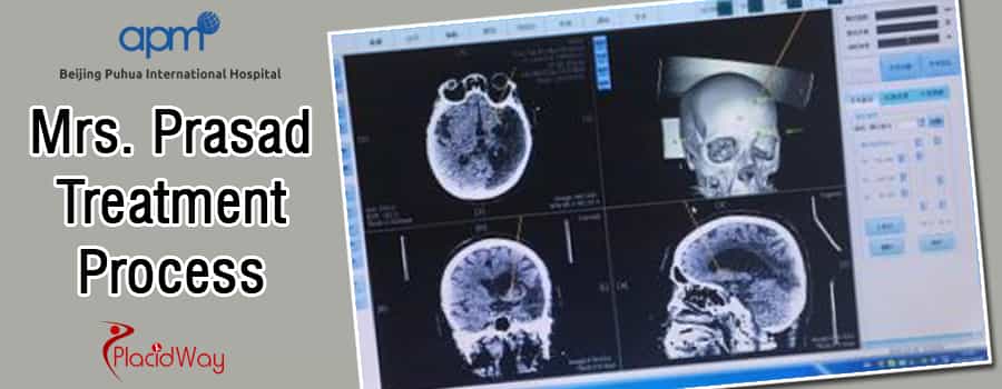 Минимально инвазивное восстановление головного мозга в BPIH Minimally Invasive Brain Repair at BPIH