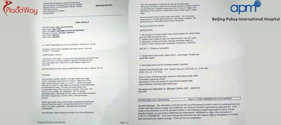 HIFU Treatment for Pancreas Cancer at BPIH