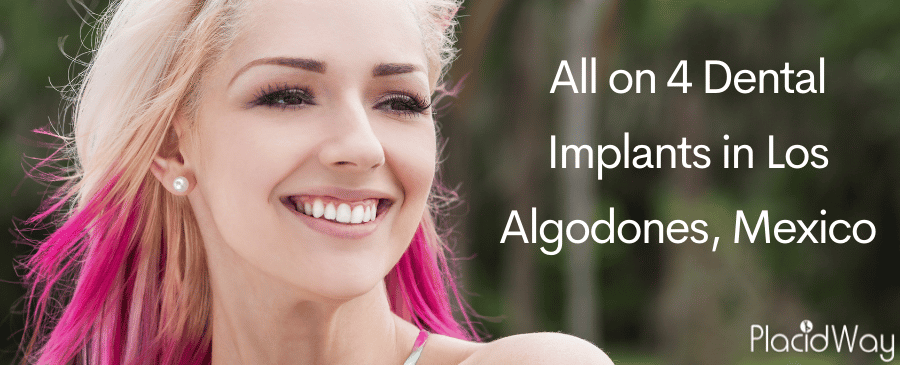 All On  Dental Implants In Los Algodones, Mexico