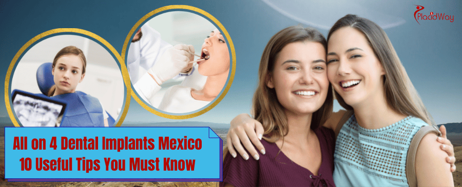 all on 4 dental implants in Mexico