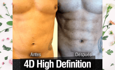 Cirugía Plástica en Reynosa México por Hospital Los Lagos