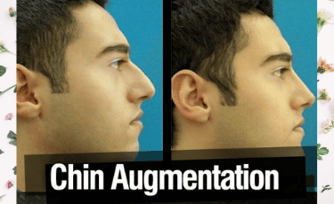 Cirugía Plástica en Reynosa México por Hospital Los Lagos