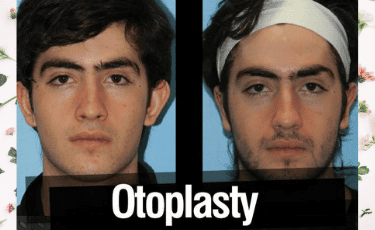 Cirugía Plástica en Reynosa México por Hospital Los Lagos