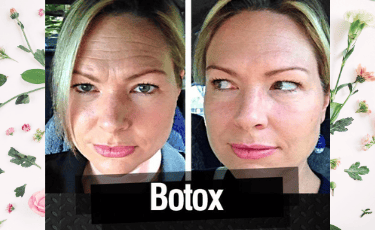 Cirugía Plástica en Reynosa México por Hospital Los Lagos