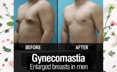 Cirugía Plástica en Reynosa México por Hospital Los Lagos