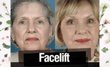 Cirugía Plástica en Reynosa México por Hospital Los Lagos