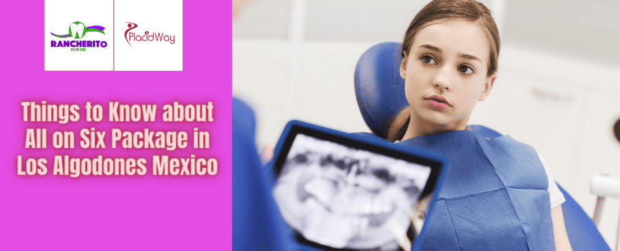 Paquete All on Six en Los Algodones México por Rancherito Dental