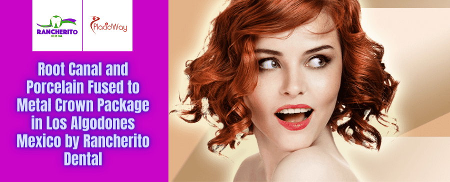 Tratamiento de conductos y corona de porcelana fusionada con metal en Los Algodones, México, por Rancherito Dental