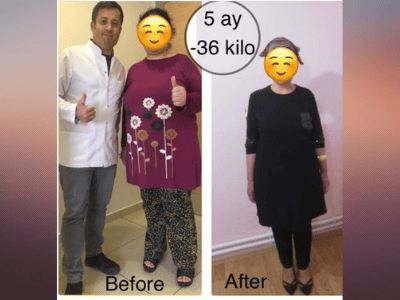 مستشفى ألغوميد الخاص | أفضل مستشفى في أضنة، تركيا