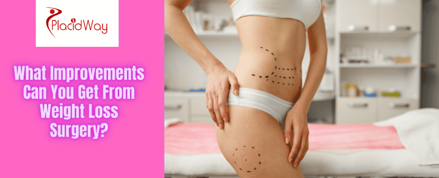 Cirugía para bajar de peso en México: 14 cosas que debes saber