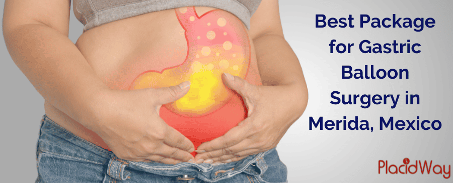 Gastric Balloon Surgery in Merida, Mexico