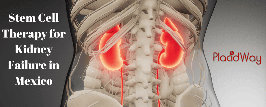 Stem Cell Therapy for Kidney Failure in Mexico