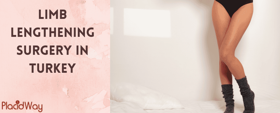 Illustration of the limb lengthening process on a leg bone