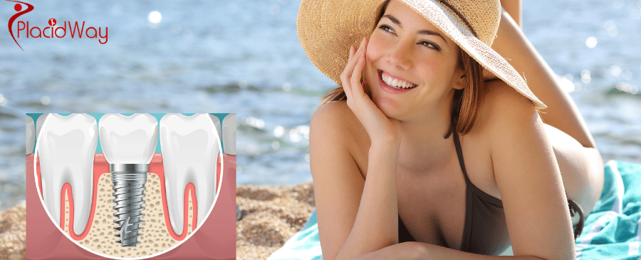 Dental Implants in Costa Rica