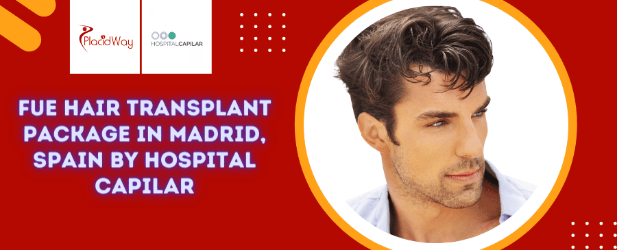 Paquete de trasplante de cabello FUE en Madrid, España por Hospital Capilar