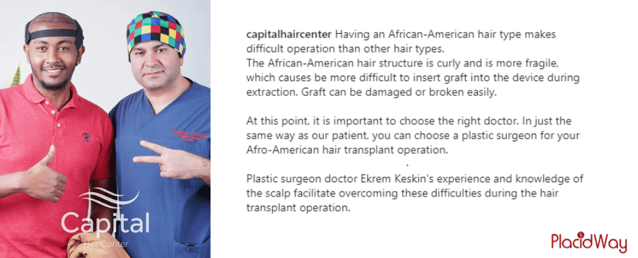 Testimonios de pacientes de trasplante de cabello en Estambul, Turquía, por Capital Hair Center