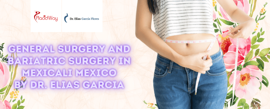 Cirugía Bariátrica en Mexicali México por el Dr. Elías García