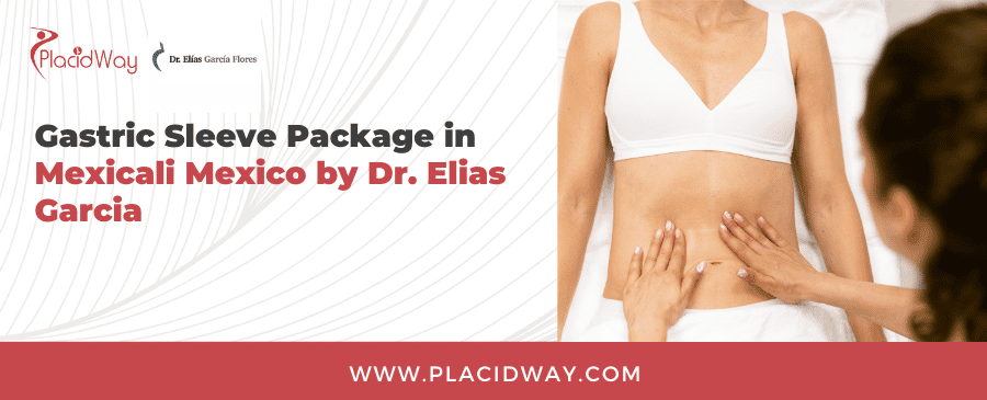 Paquete de Manga Gástrica en Mexicali México por el Dr. Elías García