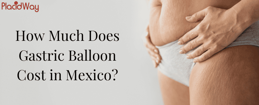 Gastric Balloon Cost in Mexico Gastric Balloon Cost in Mexico