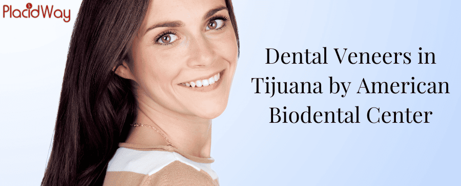 Dental Veneers in Tijuana Dental Veneers in Tijuana