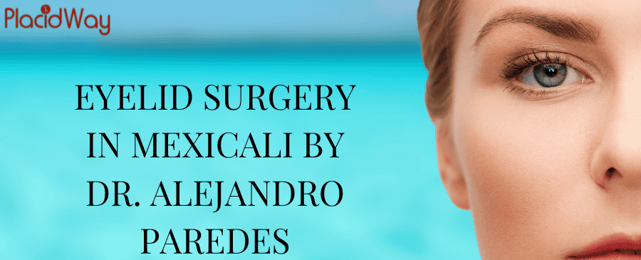 EYELID SURGERY IN MEXICALI BY DR. ALEJANDRO PAREDES