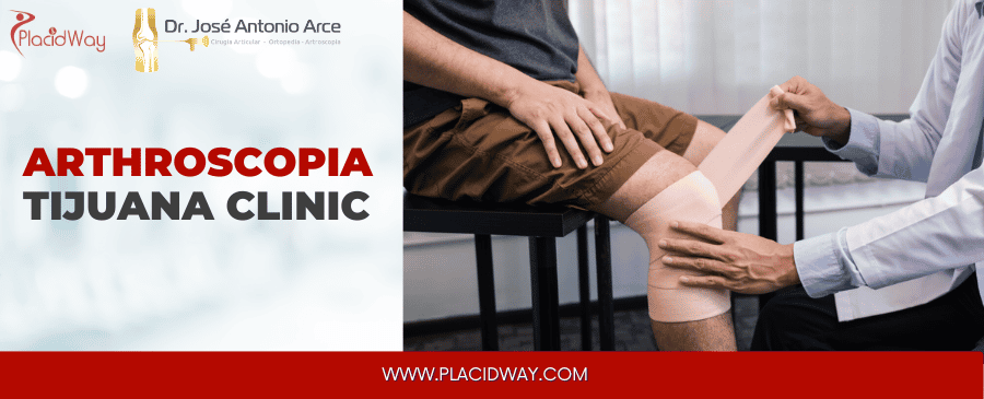 Arthroscopia Clinic Tijuana