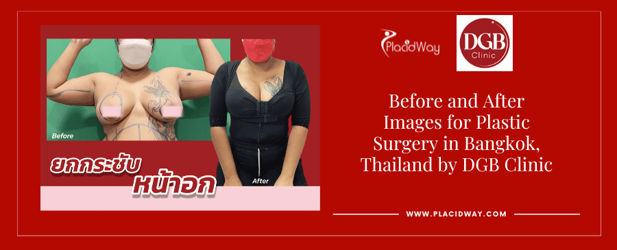 Vor und nach der plastischen Chirurgie in Bangkok, Thailand
