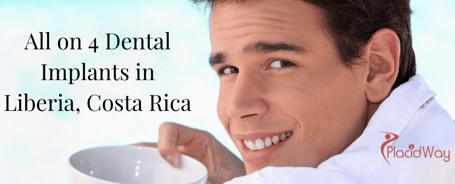 Implantes dentales All on 4 en Liberia, Costa Rica All on 4 Dental Implants in Liberia, Costa Rica