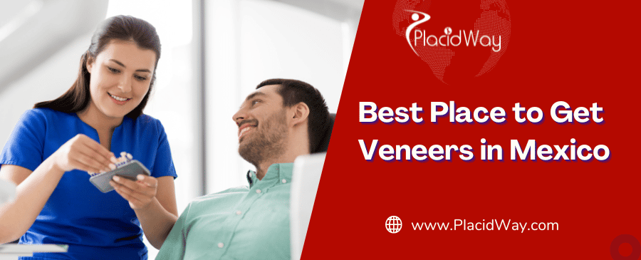 Best Place to Get Veneers in Mexico