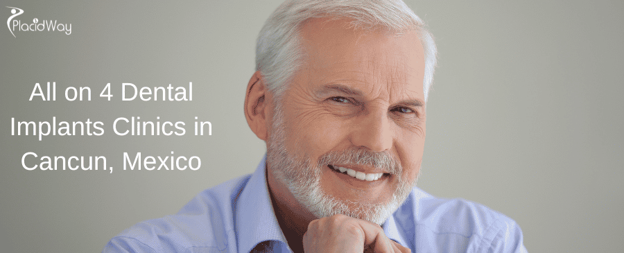 All On  Dental Implants Clinics In Cancun, Mexico
