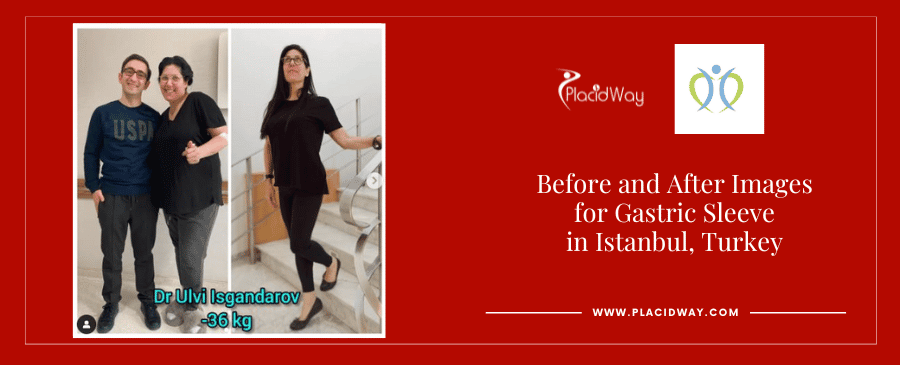 WLS in Istanbul Turkey