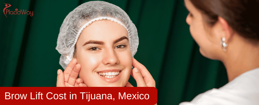 Brow Lift Cost in Tijuana, Mexico Brow Lift Cost in Tijuana, Mexico