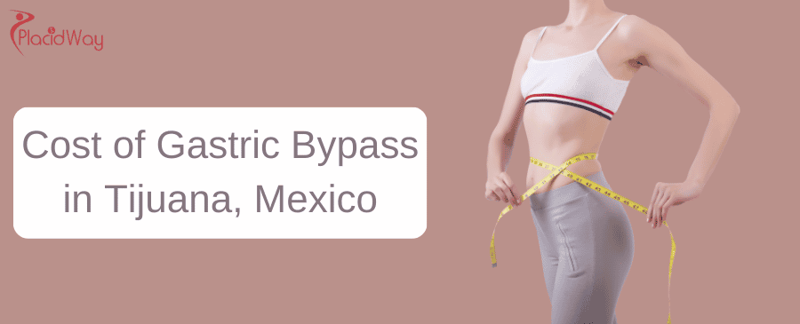 Cost of Gastric Bypass in Tijuana, Mexico