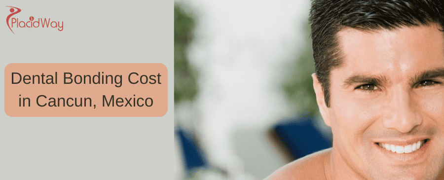 Dental Bonding Cost In Cancun, Mexico