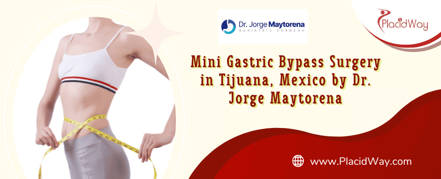 Cirugía de Mini Bypass Gástrico en Tijuana, México por el Dr. Jorge Maytorena