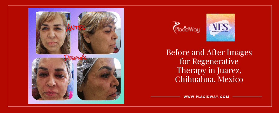 Imágenes de antes y después de Medicina Regenerativa en Juárez, Chihuahua, México