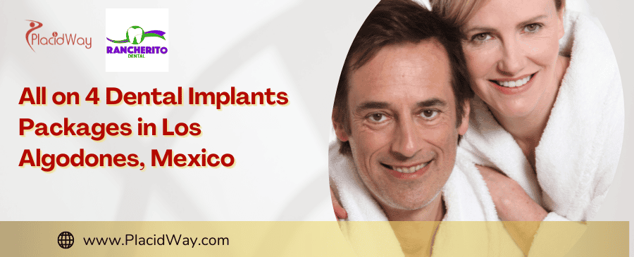 Paquetes Todo en 4 Implantes Dentales en Los Algodones, México
