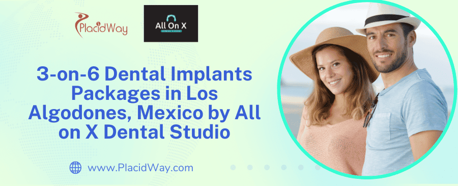 Paquetes de Implantes Dentales 3 contra 6 en Los Algodones, México