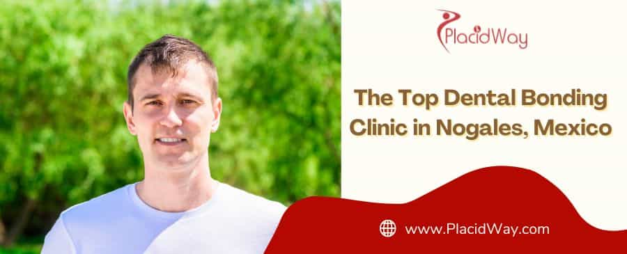 The Top Dental Bonding Clinic In Nogales, Mexico