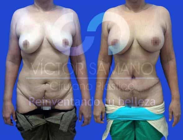 MMO en Cancún México