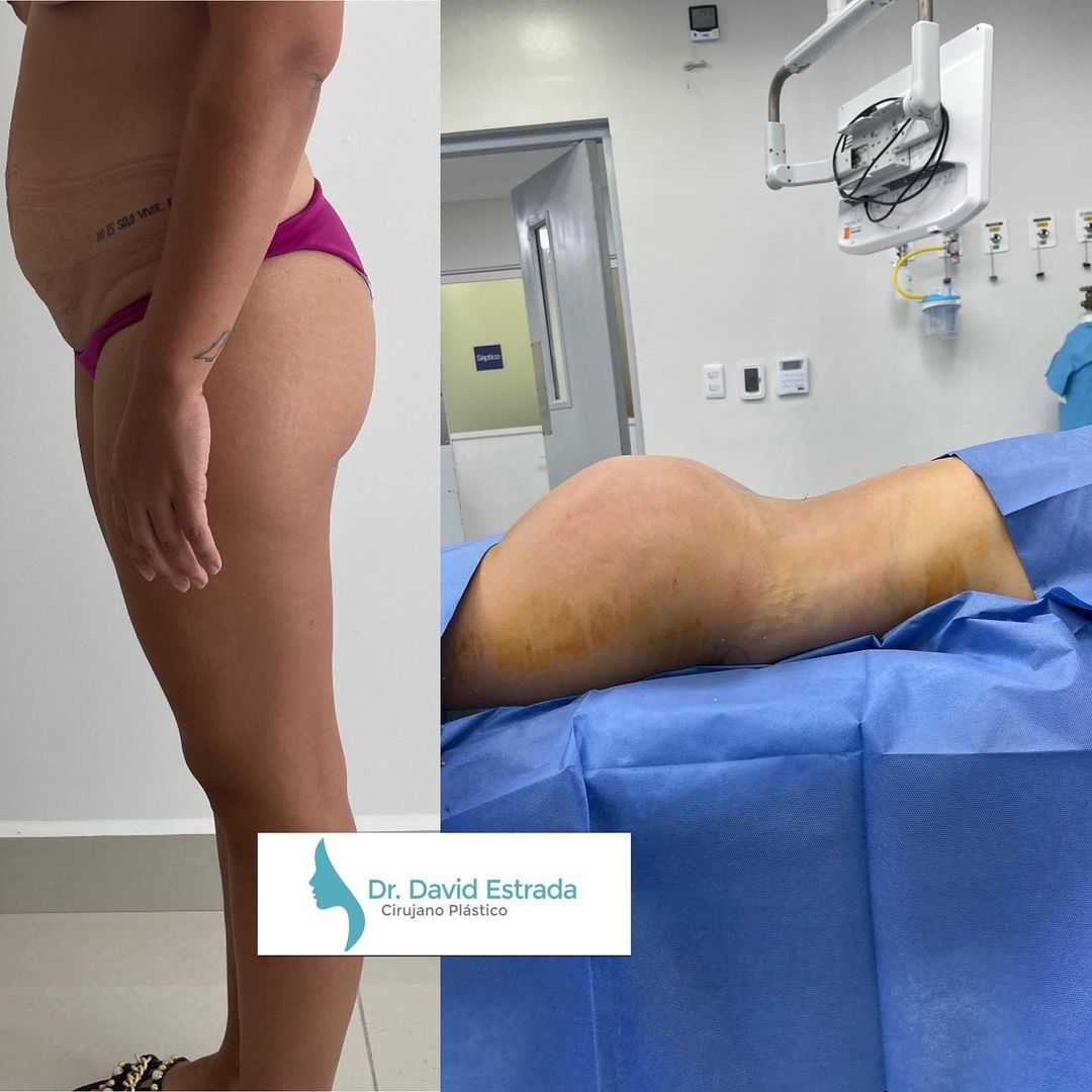 Imágenes de antes y después del cambio de imagen para mamás del Dr. David Estrada