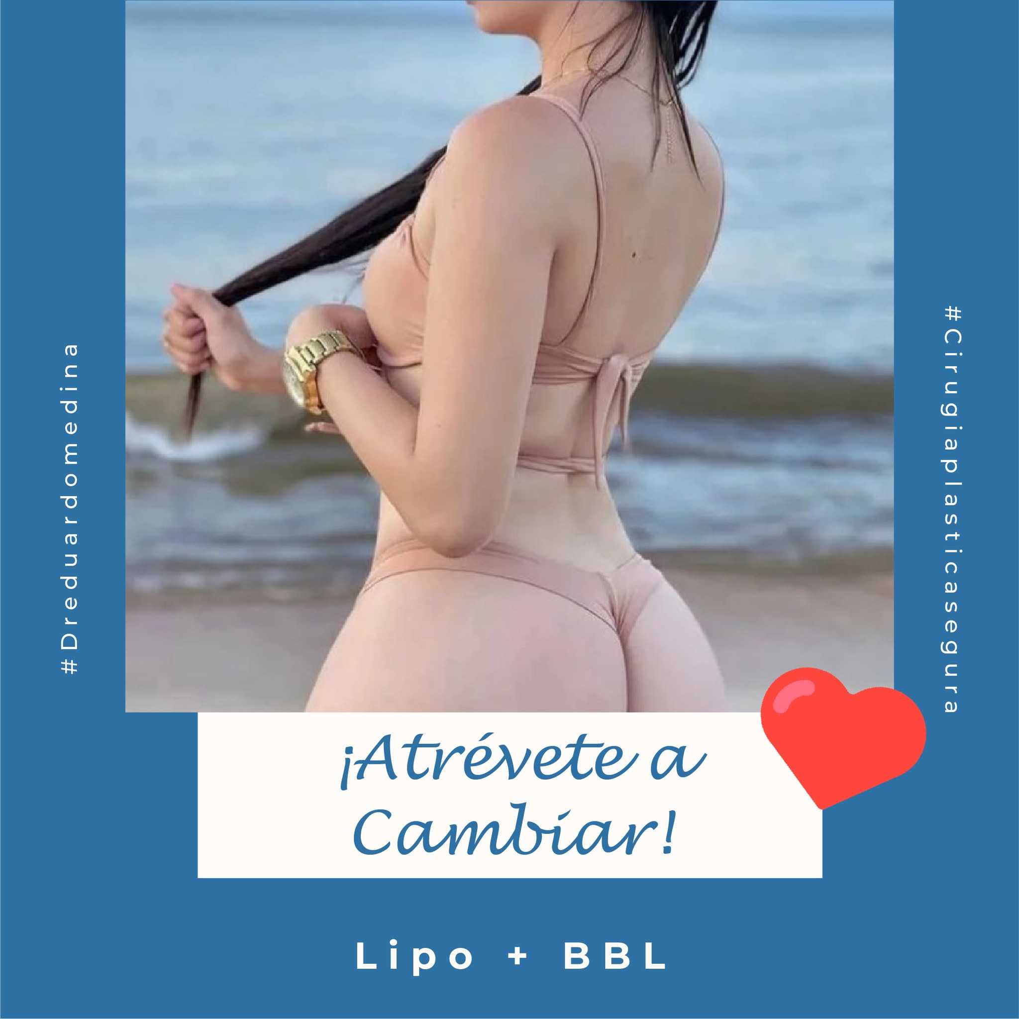 Imágenes de antes y después de BBL en Mérida, México