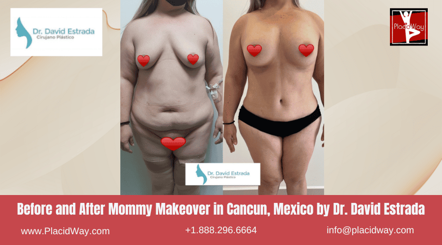 Mmo In Cancun, Mexico Dr. David Estrada