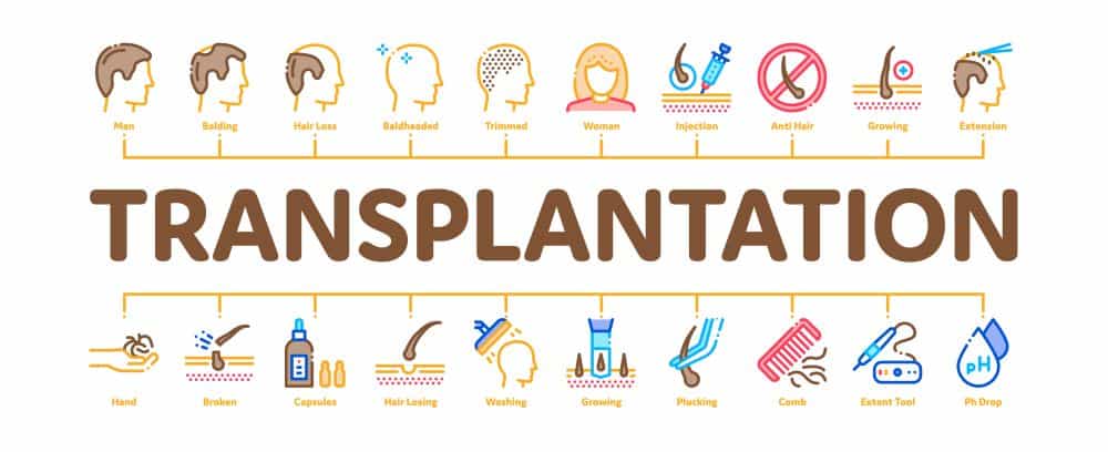 Types of Hair Transplant Types of Hair Transplant