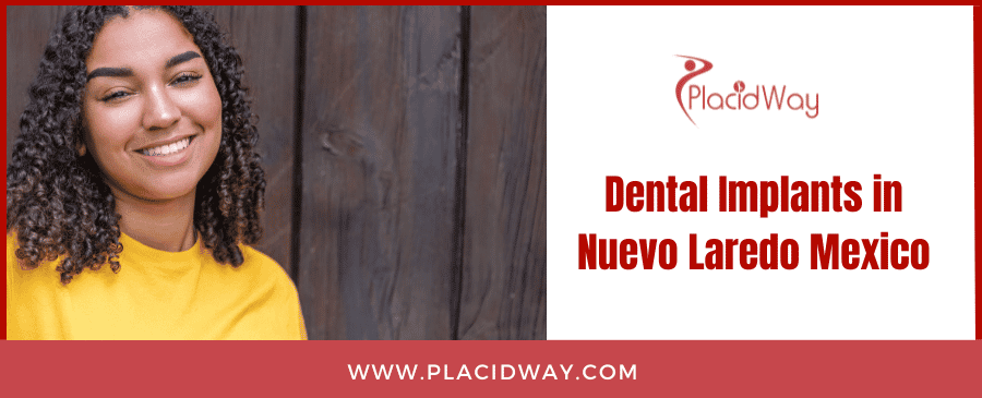 Dental Implants in Nuevo Laredo Mexico Dental Implants in Nuevo Laredo Mexico